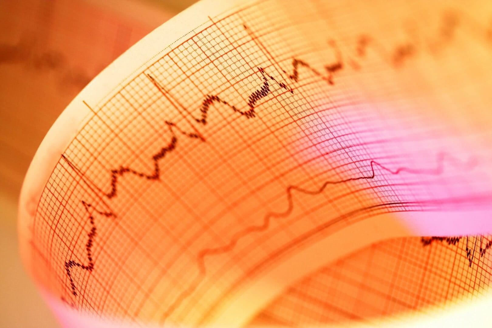 A close up image of an ecg chart.