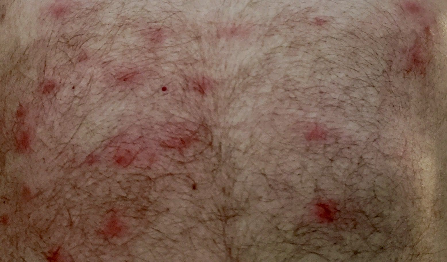 Moth Rash Barnet Outdoors in RI: Maine fishing, flea markets bring a Brown Tailed Moth ...