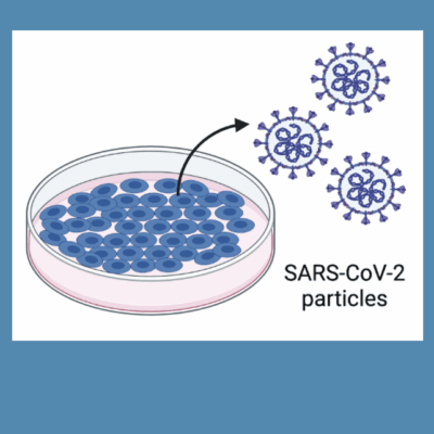 Sars coronavirus 2 particles in a petri dish.