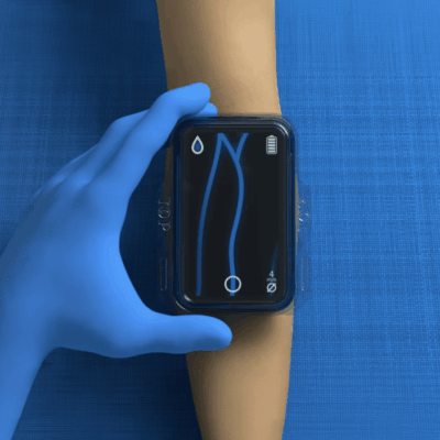 A person holding an apple watch with the ecg on.