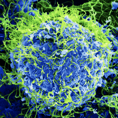 Colorized microscopic image showing Ebola virus particles in green surrounding a blue cell.