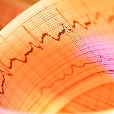A close up image of an ecg chart.